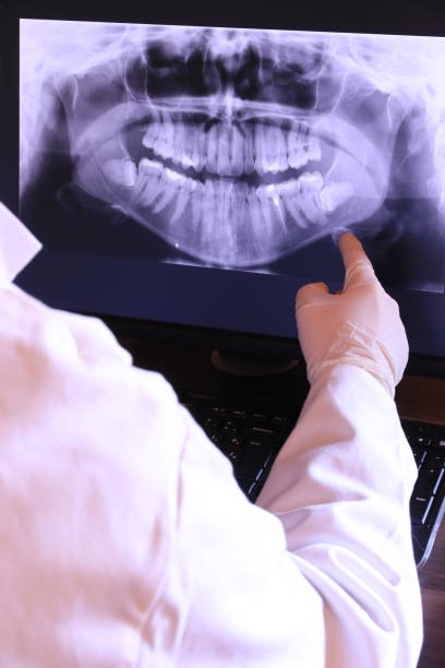 Best Emergency Wisdom Tooth Extraction in Knox, IN