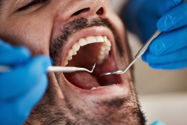 Best Emergency Dental Care for Sports Injuries in Knox, IN